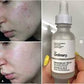 The Ordinary Niacinamide 10% + Zinc 1% – 30ml | Best Quality Niacinamide Serum